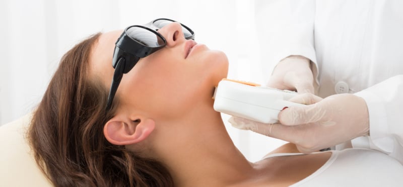 Laser Hair Removal